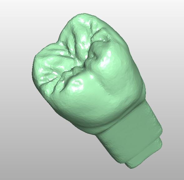 Product image 2 of the product “STL-FILES +  LIBRARY  - Upper jaw-MODELL with PIN- LIBRARY  for exocad by M. Anger ”