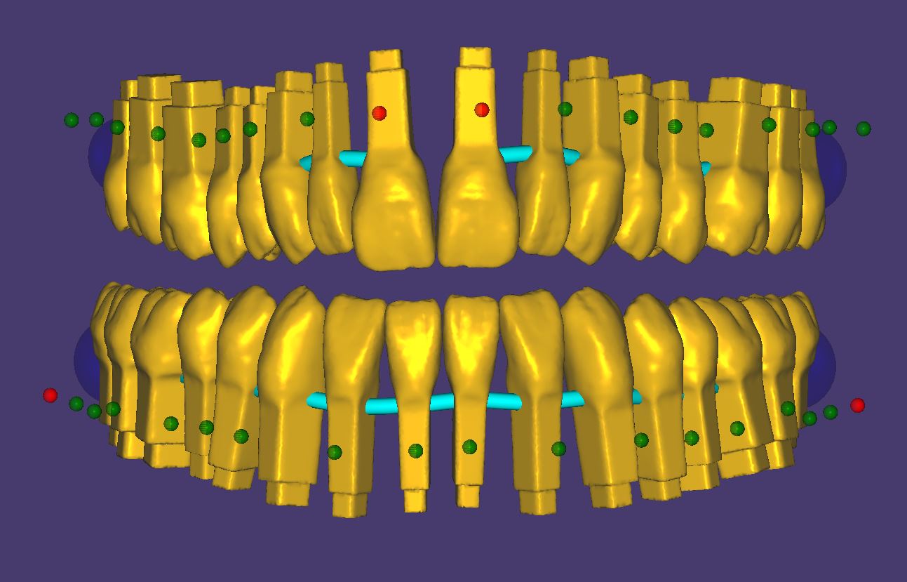 Product image 2 of the product “New Library : DENTALLIGENT-PINS ”