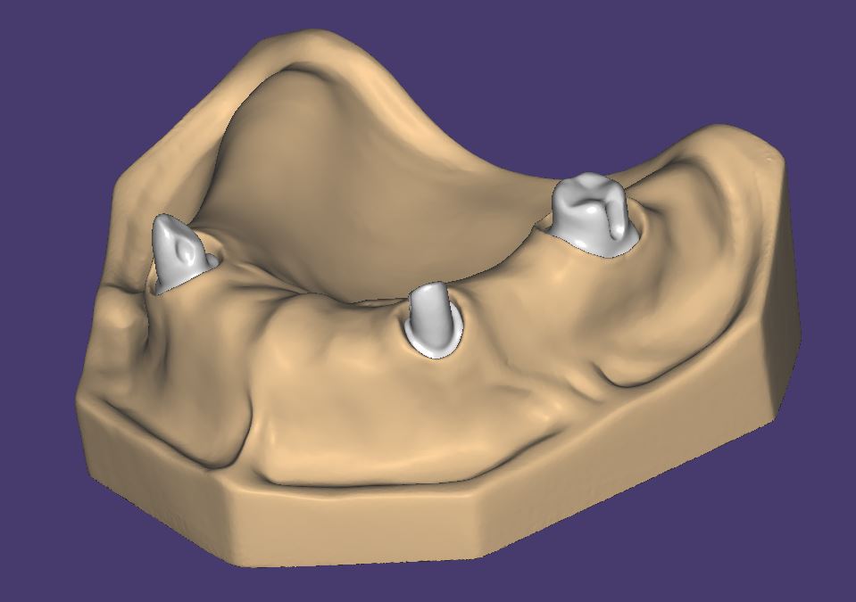 Product image 3 of the product “OK-Model T3-STL-Files for self-print ”