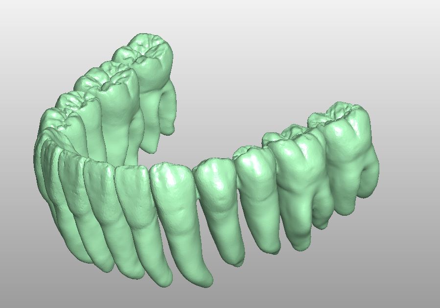Product image 3 of the product “STL-FILES  - upper jaw & lower jaw teeth row matching each other to print by yourself. ”