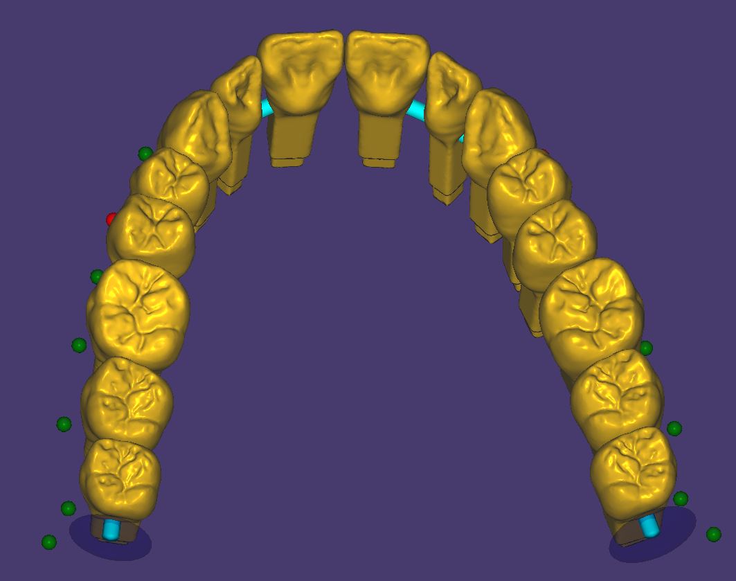 Product image 3 of the product “New Library : DENTALLIGENT-PINS ”