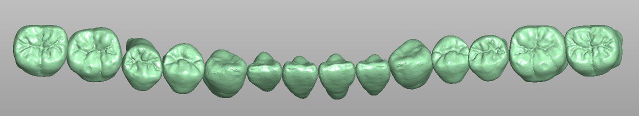 Product image 4 of the product “28 root teeth individually in full anatomy as STL library  by M. Anger ”