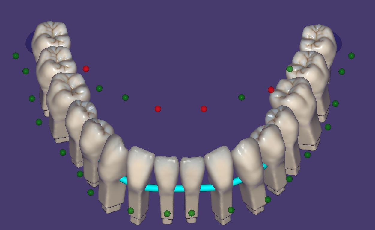Product image 4 of the product “New Library : DENTALLIGENT-PINS ”