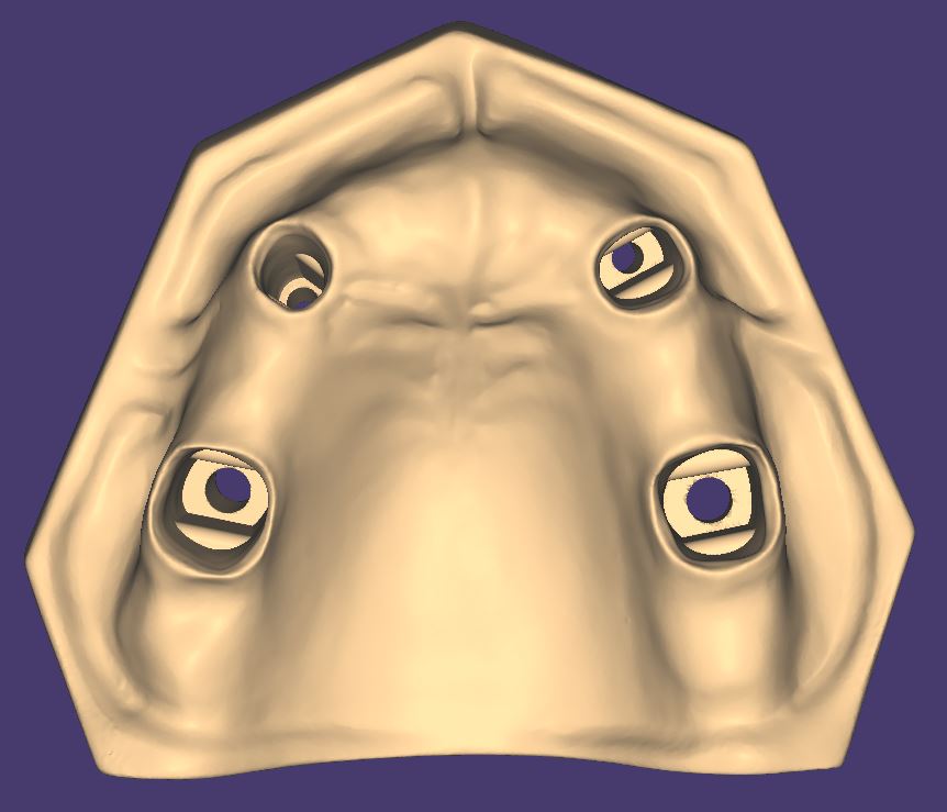 Artikelbild 5 des Artikels “OK-Modell T2-STL-Daten zum selbst drucken “