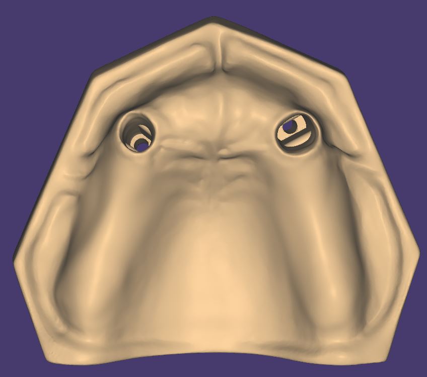 Product image 5 of the product “OK-Model T1-STL-Files for self-print ”