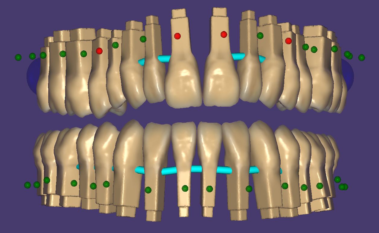 Product image 6 of the product “New Library : DENTALLIGENT-PINS ”